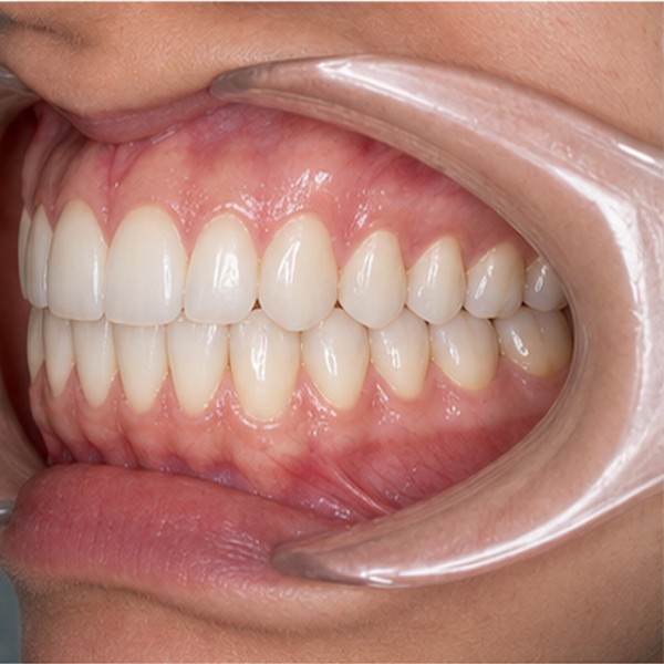 Vista clínica: Intraoral I
